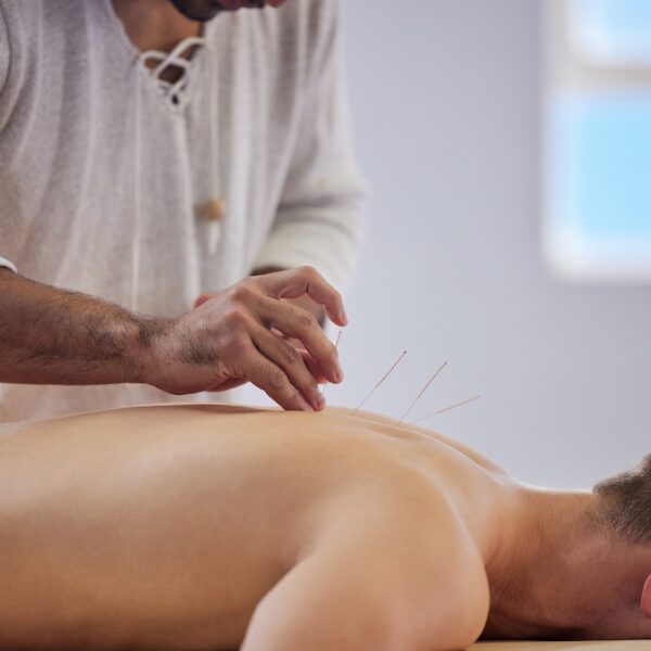 Traditional Acupuncture- All You Have To Know About It