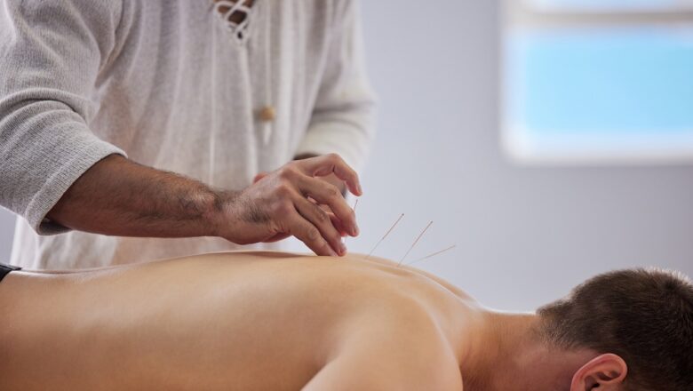 Traditional Acupuncture- All You Have To Know About It
