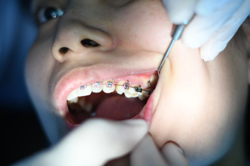 A photo showing a woman with braces undergoing an examination.