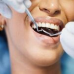 Restorative Dentistry in San Francisco- Comprehensive Solutions for a Healthier, More Beautiful Smile