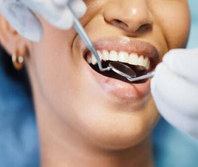 Restorative Dentistry in San Francisco- Comprehensive Solutions for a Healthier, More Beautiful Smile